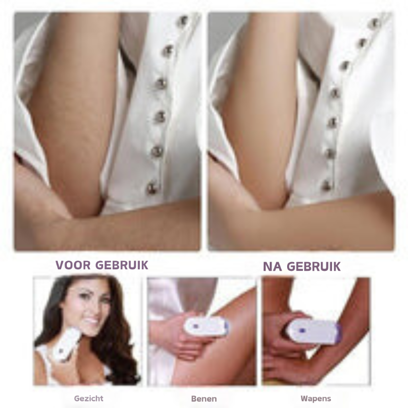 Vrouwen Laser Epilator