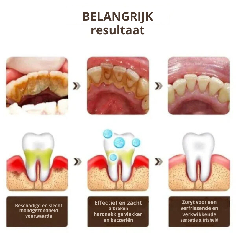 YAYASHI Probiotische Witte Tandpasta - Verwijdert Verkleurde Tanden en Tandplak
