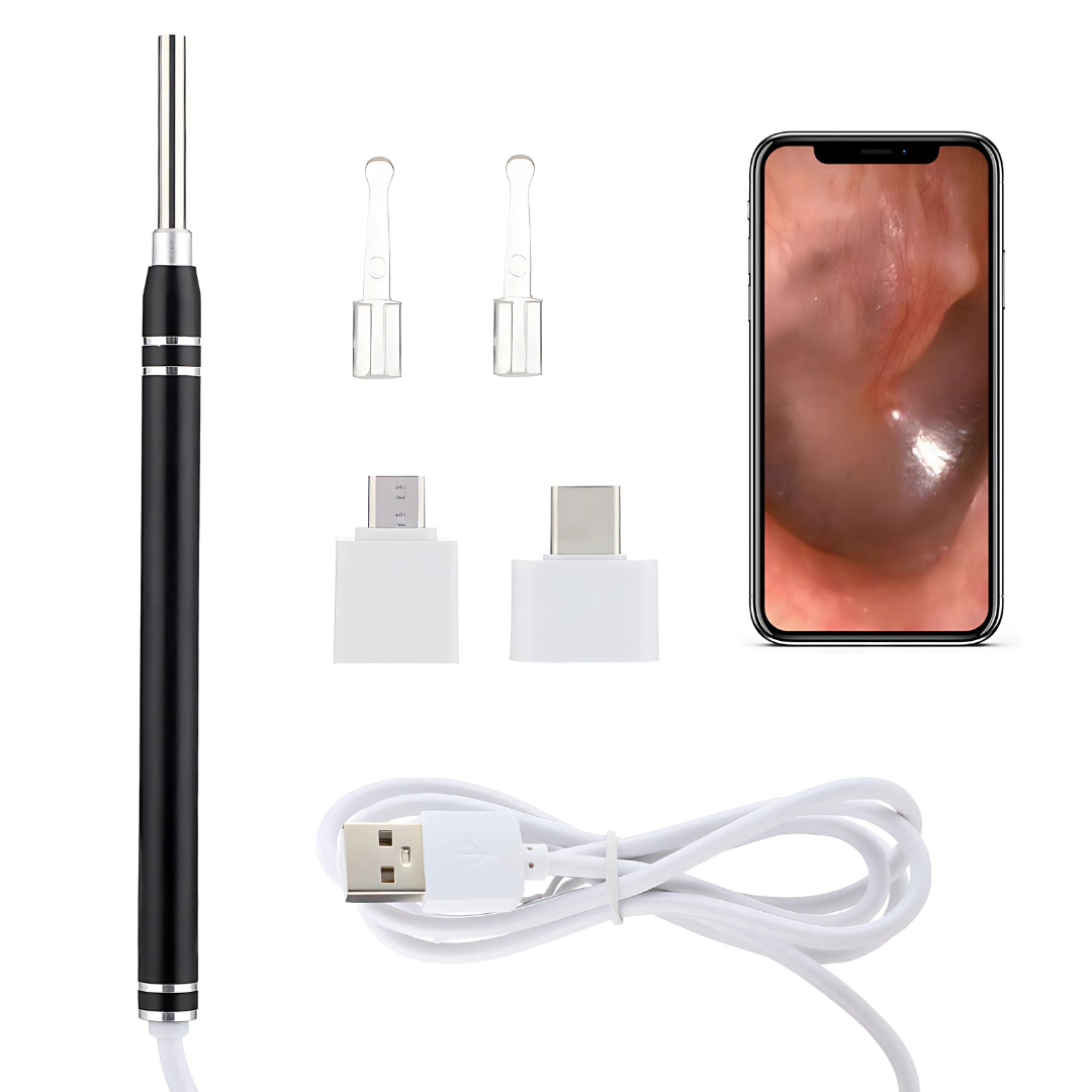 3-in-1 USB Otoscope Oorwas Reiniging - HD Camera & LED Licht voor Eenvoudige Oor- en Lichaamsinspectie