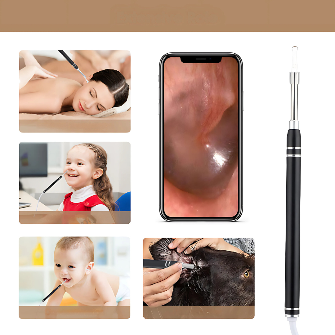 3-in-1 USB Otoscope Oorwas Reiniging - HD Camera & LED Licht voor Eenvoudige Oor- en Lichaamsinspectie